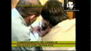 camarografo de canal 9 baleado por policia [upl. by Sumahs]