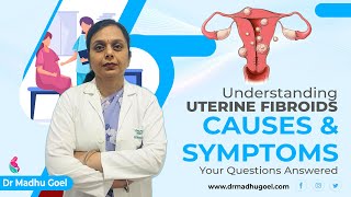 Understanding Fibroids Causes Symptoms and Diagnosis  Dr Madhu Goel [upl. by Molini]