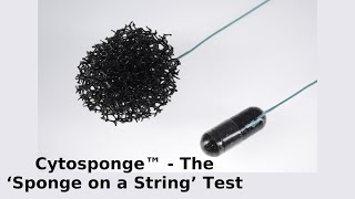 Cytosponge™  The ‘Sponge on a String’ Test [upl. by Inaflahk374]