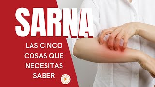 SARNA  Las 5 cosas que necesitas saber [upl. by Jueta]