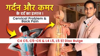 FullVideo👉C4 C5 C5C6 amp L4 L5 L5 S1 Disc Bulge  गर्दन और कमर के दर्द का इलाज Cervical amp Back Pain [upl. by Ettelohcin]