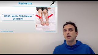 Periostite o Medial Tibial Stress Syndrome cosa e cosa si fa [upl. by End]