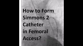 Shaping Simmons 2 Catheter for Cerebral Angiogram  Femoral Access [upl. by Lexy]