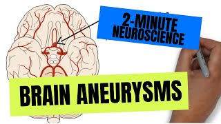 2Minute Neuroscience Brain Aneurysms [upl. by Ettelliw]