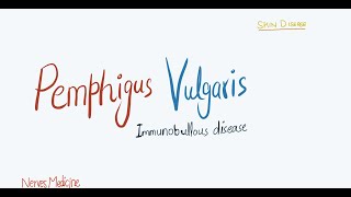 Pemphigus Vulgaris  clinical features pathophysiology and histology  immunobullous skin disease [upl. by Dory]