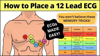 12 Lead ECG Placement MADE EASY EMT Nursing Paramedic ecg nursing [upl. by Gradeigh]