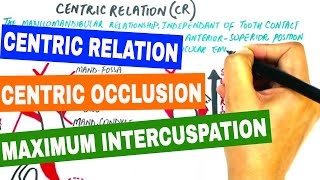 Centric Relation Centric Occlusion amp Maximum Intercuspation [upl. by Nina]