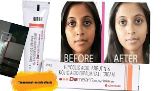 demelan cream uses in tamil  tan removal cream by dermatalogist  review tanremoving [upl. by Netaf]