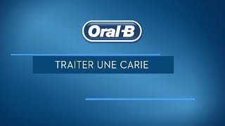 Comment soigner une carie dentaire [upl. by Adila]