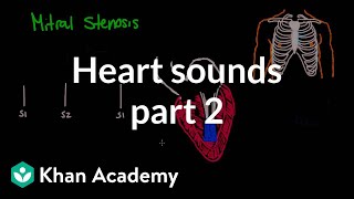 Systolic murmurs diastolic murmurs and extra heart sounds  Part 2  NCLEXRN  Khan Academy [upl. by Coriss]