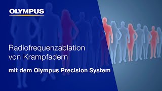 Krampfadern schonend und sicher behandeln  Precision System  OLYMPUS [upl. by Ayres473]