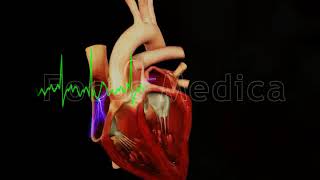 Types of atrial fibrillation  Animated Atlas of Atrial Fibrillation [upl. by Akcired244]