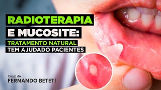 RADIOTERAPIA E MUCOSITE TRATAMENTO NATURAL TEM AJUDADO PACIENTES  DR VLADIMIR NORONHA  BETETI [upl. by Adnilrem147]