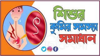 শিশুর পেটে কৃমি হবার কারণ লক্ষণ ও ঘরোয়া সমাধান। কৃমির ঘরোয়া চিকিৎসা I Pete krimi hole ki koronio [upl. by Lesya]