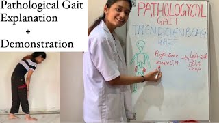 Pathological Gait  Exercise Therapy  Types Explained  physiotherapy [upl. by Anelec464]