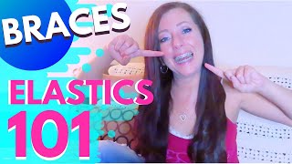 ORTHO ELASTICS 101 FOR BRACES  DONNELLE GRIFFIN [upl. by Ennayram]