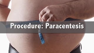 How is a Paracentesis completed and why [upl. by Nevek479]