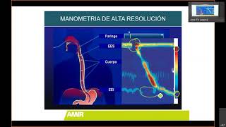 ENARM 2021 clase de Gastroenterología parte 1 [upl. by Odlabu]