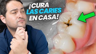 LA VERDAD SOBRE LA CARIES DENTAL ¿Como curarla en casa [upl. by Rehpotsrihc]