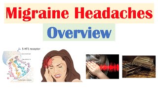 Migraine Headache Overview  Pathophysiology Triggers Phases Symptoms Diagnosis Treatment [upl. by Nehepts]