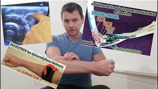 Épicondylite Latérale  AutoOstéopathie par Adhésiolyse Manuelle tennis elbow [upl. by Hamel191]