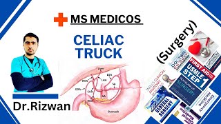 Celiac TruckSurgeryAnatomyMS Medicos Dr Rizwan Urdu Hindi Easy Explanations [upl. by Eddy]