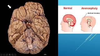 4 neuroscience tutorials QampA [upl. by Ogdon]