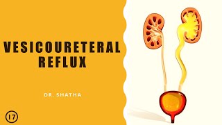 Vesicoureteral Reflux  Drshatha  Lecture 17 [upl. by Ochs]