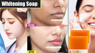 Skin Whitening Soap with Salicylic Acid  Benefits Uses amp Side Effects [upl. by Akimehs]