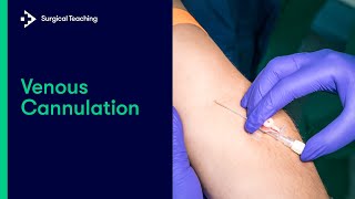 Intravenous IV Cannulation  An Essential Guide [upl. by Carolyne]