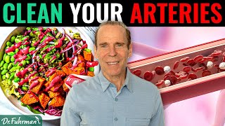 Can a Nutritarian Diet Remove Calcified Plaque in Arteries  Dr Joel Fuhrman [upl. by Putnem]