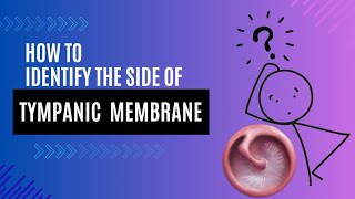 Learn how to identify the side of the tympanic membrane 😊 [upl. by Oinotnas]