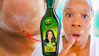 I Used AMLA OIL On My Skin Everyday FOR 12 DAYS [upl. by Cut]