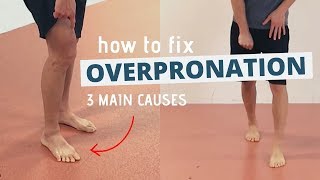 Pronated Feet and How to Fix 3 Different Causes of OVERPRONATION [upl. by Ecirtaeb]