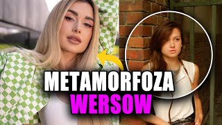 Metamorfoza Wersow “Ten zabieg też był źle wykonanyquot [upl. by Guild]