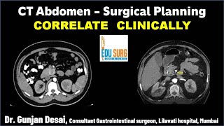 Correlate Clinically  Abdomen Imaging  CT scan abdomen interpretation  Radiology masterclass [upl. by Strain]