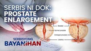 Ano ang pwedeng inumin para malunasan ang prostate enlargement [upl. by Sand]