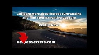 Herpes Cure Vaccine amp Research  Herpes 2018 News [upl. by Akelahs957]