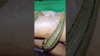 eczema treatment  Leech Therapy for eczema shortsfeed alternativemedicine alternativemedicine [upl. by Elidad750]