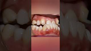 Orthodontie transformation [upl. by Luht]