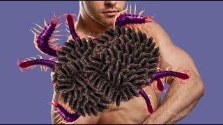 ASMR animation treatment How to removal worms injured back side Deep cleaning asmr animation 165 [upl. by Wesley]