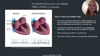 Afib presentation [upl. by Nette]