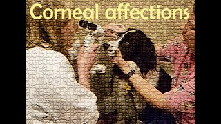 Affections of the cornea part 8 [upl. by Edmonds]