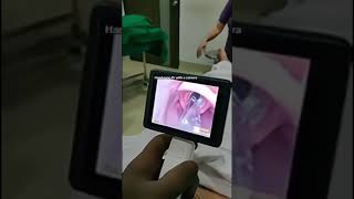 Video laryngoscope intubation [upl. by Adrienne550]