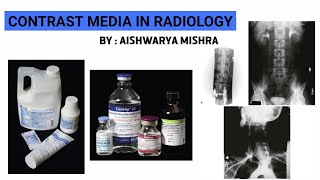 CONTRAST MEDIA IN RADIOLOGYPART1  BY  AISHWARYA MISHRA [upl. by Jacobine432]