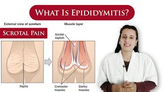 What is Epididymitis  causes symptoms treatment  scrotal pain  By Dr N Joshi [upl. by Aidyl292]