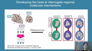 Selective Neuronal Vulnerability in Neurodegeneration [upl. by Nauqal181]