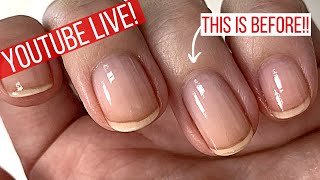 Fixing cuticles for good How to do this the EASY WAY [upl. by Leisam851]