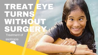 Treatment for eye turns without surgery  Vision Therapy for Esotropia [upl. by Llerrom]