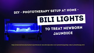 DIY Phototherapy Bili Lights setup at home to treat Newborn Jaundice [upl. by Htrowslle507]